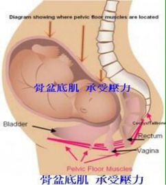 產(chǎn)后盆底康復(fù)治療開始后，出現(xiàn)陰道出血怎么破？