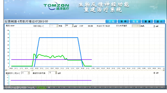 盆底康復(fù)治療怎么做？盆底康復(fù)治療肌電生物反饋治療儀的機(jī)理是什么？