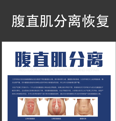 馬麗挺孕肚登春晚，孕婦還應(yīng)該知道腹直肌分離的相關(guān)知識(shí)