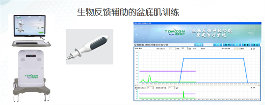 產(chǎn)后修復(fù)|盆底肌肉功能電刺激有什么作用？生物反饋呢？
