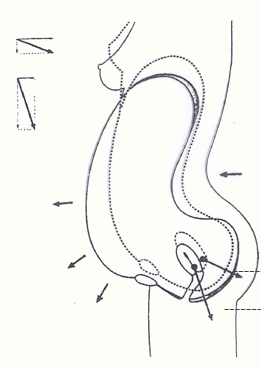 產(chǎn)康者腹直肌分離的理論知識不過關(guān)？你還怎么開展產(chǎn)后項目呢！
