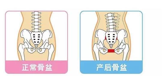 為什么每個(gè)成年女性都應(yīng)該堅(jiān)持訓(xùn)練盆底??？