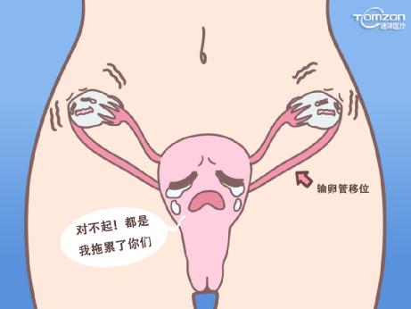 盆底康復(fù)治療儀主要是改善盆底功能障礙嗎？