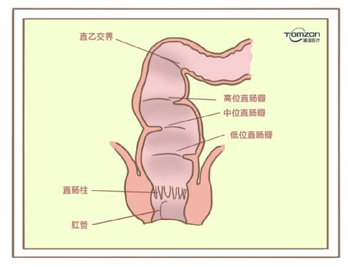 盆底康復治療儀對產(chǎn)后便秘有哪些幫助？