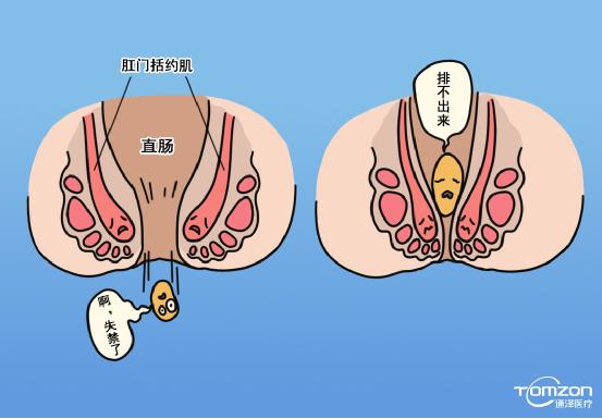 盆底康復(fù)治療儀是否可以體現(xiàn)針對(duì)性的效果？