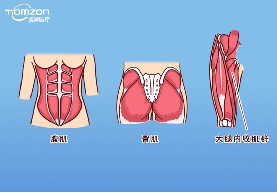 產(chǎn)后康復儀能不能改善尿失禁？