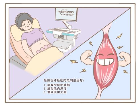  停經(jīng)無小事，盆底康復(fù)治療儀值得關(guān)注