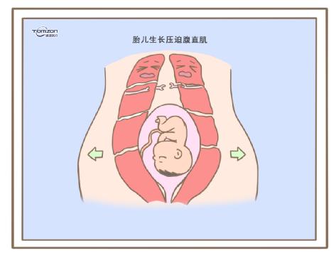 盆底肌修復(fù)儀器.jpg